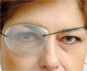 Translucent Eye Patch (VTE)