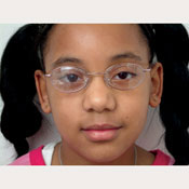  Amblyopia Cling Patch   20/100 Blur   (Package of 10)