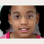  Amblyopia Cling Patch   20/200 Blur   (Package of 10)