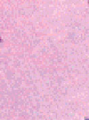  Lens Cleaner Cloths   Standard   Color: Pink  (Package of 1,000)