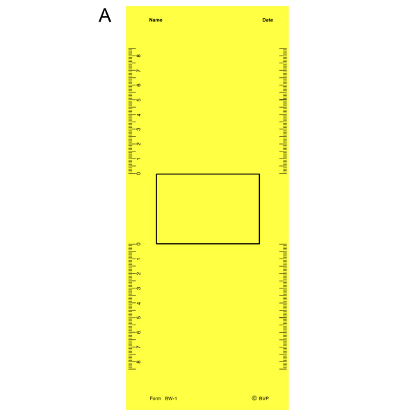 (A)   Wolff Cheiroscope  Tracing Form   (75 Sheets) 