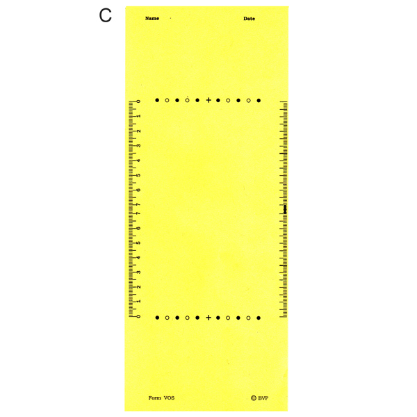 (C)  Wolff Cheiroscope  Tracing Form   (75 Sheets) 