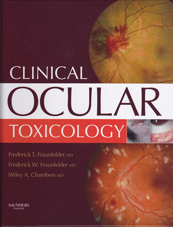 Clinical Ocular Toxicology